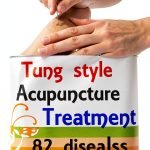 Acupuncture for Beginners: A 2nd Edition Guide by TAI LING terapias-0