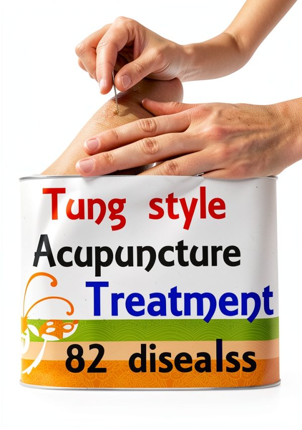 Acupuncture for Beginners: A 2nd Edition Guide by TAI LING terapias-0