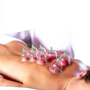 Cupping Therapy Kindle eBook - Complete Guide with XRay, Word Wise-0